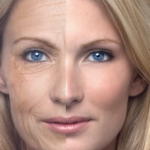 Wrinkles – Prevent Your Skin Aging