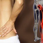Sciatica – how to get rid of pain